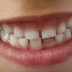 Да се погрижим за детските зъбки!