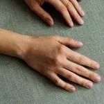 Znak na nohtih, ki lahko kažejo na bolezni srca ali jeter