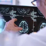 Verjamete vanje? To je 10 najpogostejših mitov in zmot o možganski kapi