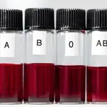 Imate to krvno skupino? Strokovnjaki opozarjajo da je povezana z nastankom sladkorne bolezni