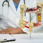 Kako zdravje črevesja vpliva na krvni tlak? Zdravnik s Harvarda razkriva, da je povezava močnejša, kot bi mislili