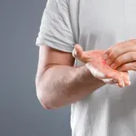 Zakaj vas srbijo dlani? Najpogostejši vzroki in znaki, ki jih ne smete prezreti