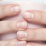 Bílé fleky na nehtech? Raději to neignorujte