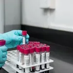 Večne hemikalije“ u 98,8 % testiranih uzoraka ljudske krvi