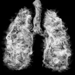 Šokantne številke: Vsako leto 1600 novih primerov pljučnega raka v Sloveniji