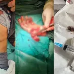 FOTO | Mostarski kirurg o petardama: "Najteža operacija trajala je osam sati, ne kvarite si blagdane"