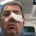 Fizički napadnut Danijel Boto