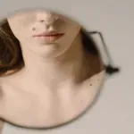 Kako prepoznati nevarna kožna znamenja in kdaj je čas za obisk dermatologa?