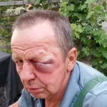 Tako so Strojanovi včeraj brutalno pretepli ljubljanskega kmeta. Minister Poklukar pa nič!