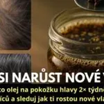 Tajemství hustých a rychle rostoucích vlasů: Vyrob si doma zázračný olej z hřebíčku a černého kmínu!