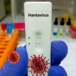 Vše, co potřebujete vědět o hantaviru: Příznaky, přenos i rizika, která lidé podceňují