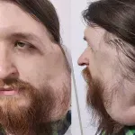 Pomozi.ba pokrenuo apel za Jasenka Ramića iz Tuzle: Za operaciju potrebno 76.500 eura