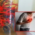 Bosanci sa visokim krvnim pritiskom otkrili novo sredstvo koje pomaže