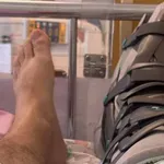 Oboževalci prestrašeni: naš znani pevec končal na operacijski mizi