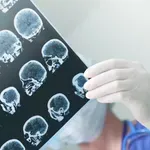 Znanstvenici upozoravaju: Skrivena mjesta gdje se masnoća nakuplja u tijelu povezana su s propadanjem mozga