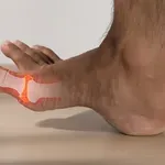 Jedno istraživanje mijenja sve što znamo o gihtu