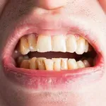 Želite doživjeti duboku starost? Tajna se skriva u vašim ustima