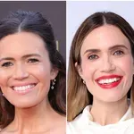 Vidite li razliku? Zvijezde vole korekciju koja umjesto pomlađivanja može - postarati