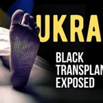 Moskva: Nezakonita presajanja organov v Ukrajini dosegla nezaslišane razsežnosti, ZN se ne odzivajo
