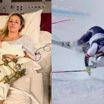 Tri operacije in še ni konec: olimpijska šampionka ne izgublja upanja