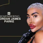 Beauty influencer mrtev po stotih kozmetičnih posegih