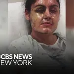 Brutalni napad s kislino