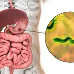 Helicobacter pylori: Skrivena bakterija koju ima svaki 3. čovjek – a može dovesti do raka
