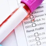 HbA1c: Ovaj broj može otkriti dijabetes i prije prvih simptoma