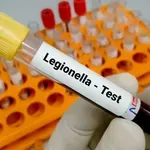 Legionarska bolest (legionela) otkrivena u zagrebačkom vrtiću! Evo koji su simptomi