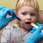 Simptomi šarlaha: Kako ga prepoznati i koliko je zarazan?