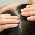 Smrad tjemena kose: 6 razloga zašto smrdi čak i nakon pranja