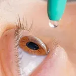 Najbolje kapi za suhe oči: Kako izabrati pravi tip prema vašim simptomima?
