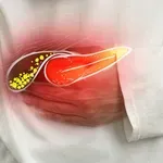 Što je dobro za žuč? Liječnici i nutricionisti slažu se oko ovih pravila