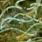 Bacillus cereus bakterija: Preživljava grijanje i uzrokuje trovanje! Evo gdje se nalazi