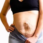 Vježbe za dijastazu: Zašto jačanje trbušnjaka često nije rješenje?