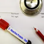 Hrana koja smanjuje CRP: Što jesti da upala prođe prirodnim putem?