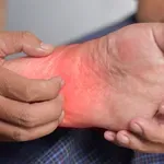 Svrbež ruku i stopala: 11 uzroka i kako prepoznati kada je vrijeme za liječnika