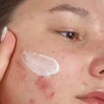 Akne kod tinejdžera: Jednostavna rutina koja stvarno djeluje (bez skupih proizvoda)