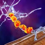 Bolest motornog neurona: Ovo su simptomi koji se pojavljuju tiho, a mijenjaju život iz temelja