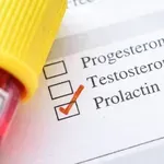 Hiperprolaktinemija: Simptomi koji ukazuju na hormonski disbalans i kako sniziti prolaktin