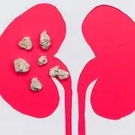 Magnezij i bubrežni kamenci: Jedna greška u prehrani povećava rizik – radite li je i vi?