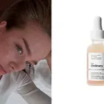 Zimska skincare pravila: Koje kiseline za lice izbegavati?