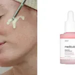 Šta je PDRN i zašto je postao neophodan korak u nezi kože?