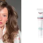 Kako zima utiče na atopijski dermatitis – i kako ga možete držati pod kontrolom?