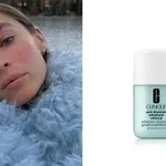 Za osetljivu kožu sklonu crvenilu, ovi anti-blemish preparati su must