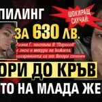 ШОКИРАЩ СЛУЧАЙ: Пилинг за 630 лв. изгори до кръв лицето на млада жена