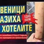 ЕДНО НАУМ: Дървеници налазиха спа хотелите