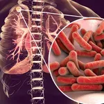 Безплатни консултации за туберкулоза в София