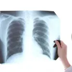 Пазете се! Туберкулозата се завръща!