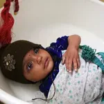 Дебили, ваксинирайте си децата. От морбили се мре!